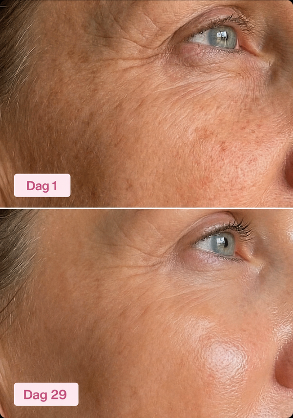 🧬 Huidregeneratie Zonder Injecties